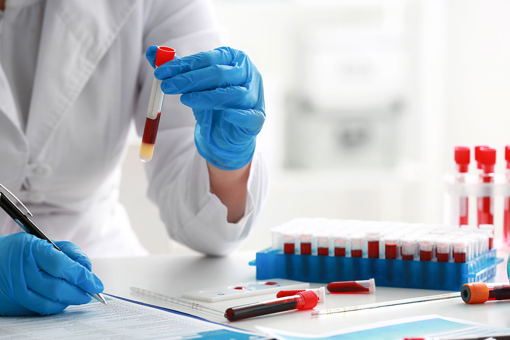 Blood sample analysis in a veterinary laboratory, highlighting diagnostic testing, disease detection, routine health screening, and comprehensive pet care.